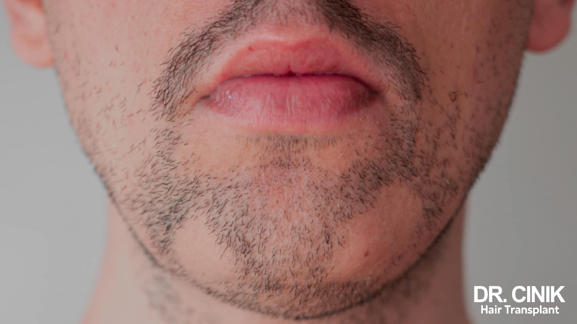 Gros plan sur le bas d'un visage masculin dont la barbe reste éparse sur les joues alors que le menton et la moustache sont mieux fournis