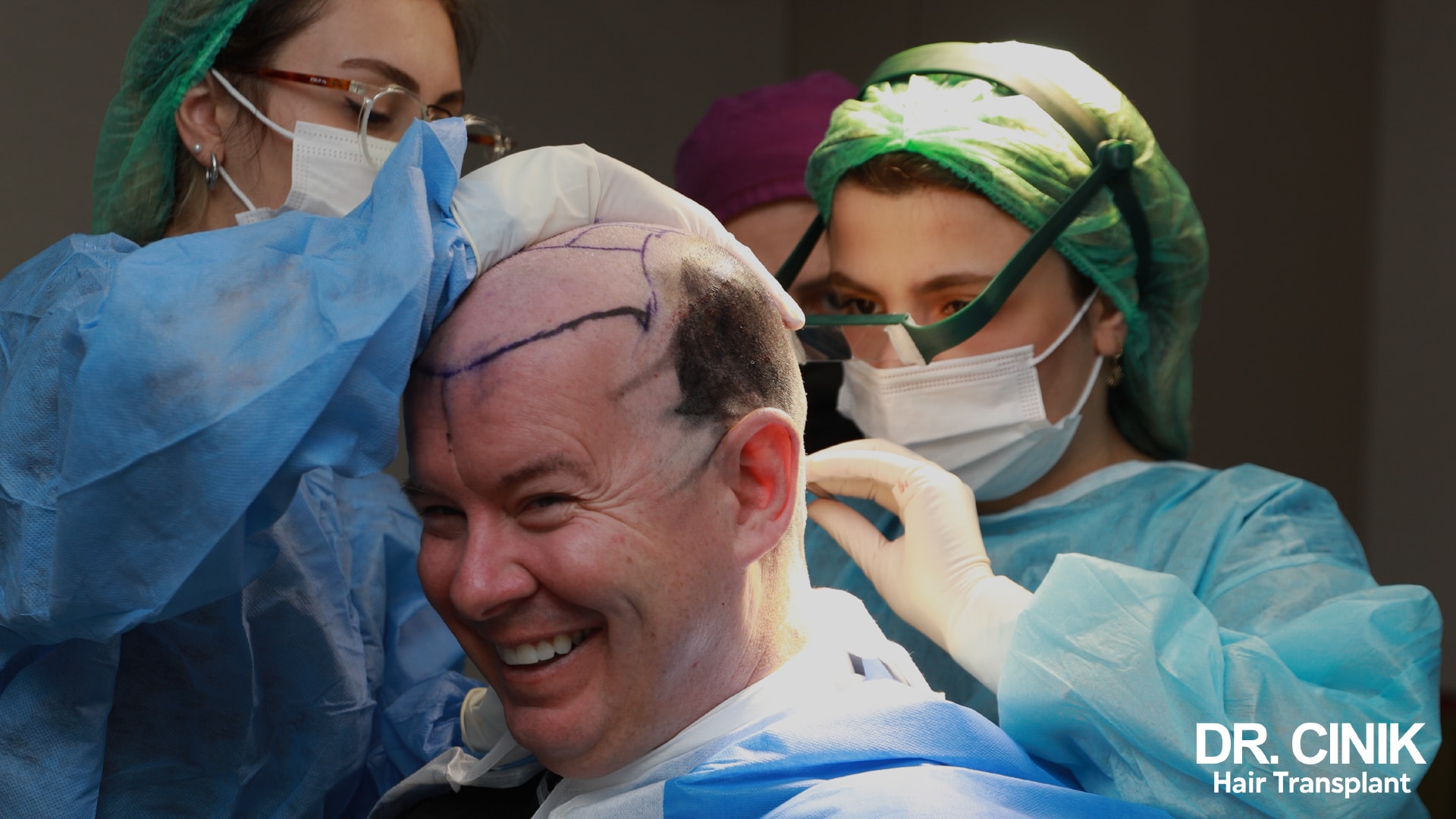 Smiling patient in the operating room, hairline drawn in felt-tip on the scalp, two assistants in sterile gowns preparing him