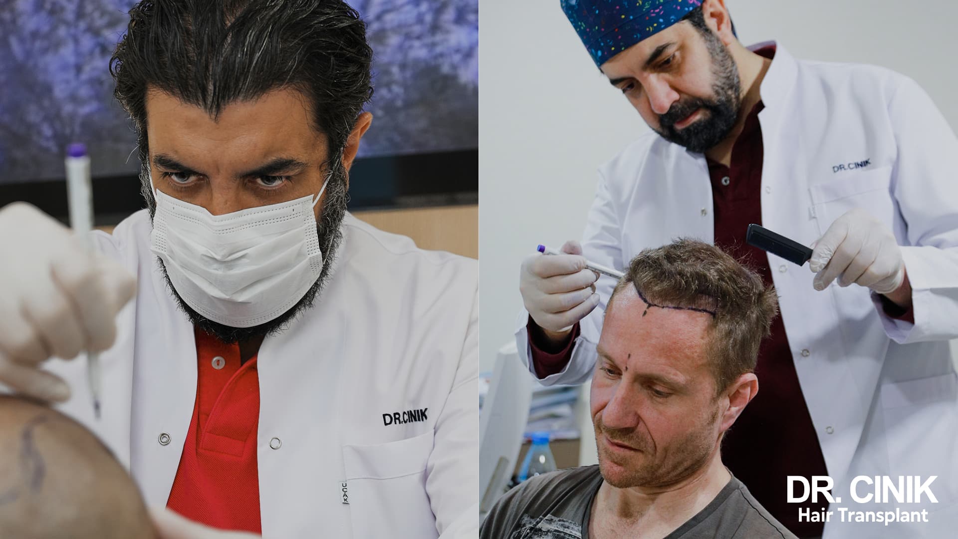 Doctor Emrah Cinik draws the new frontal hairline on a patient's scalp with a marker before the procedure