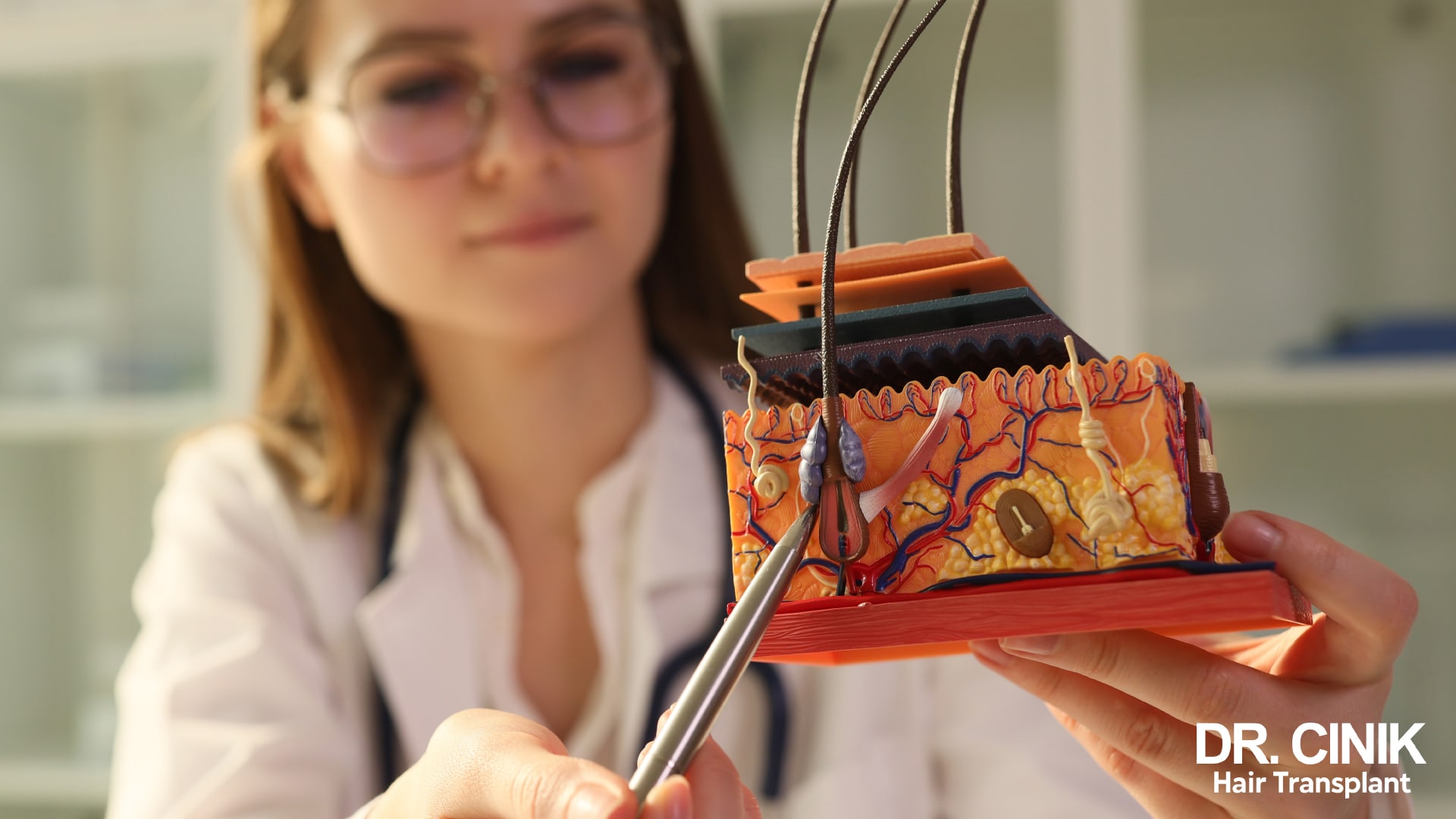 Doctor in a white coat holding an anatomical cross-section model showing a hair follicle, its blood vessels and the layers of the skin