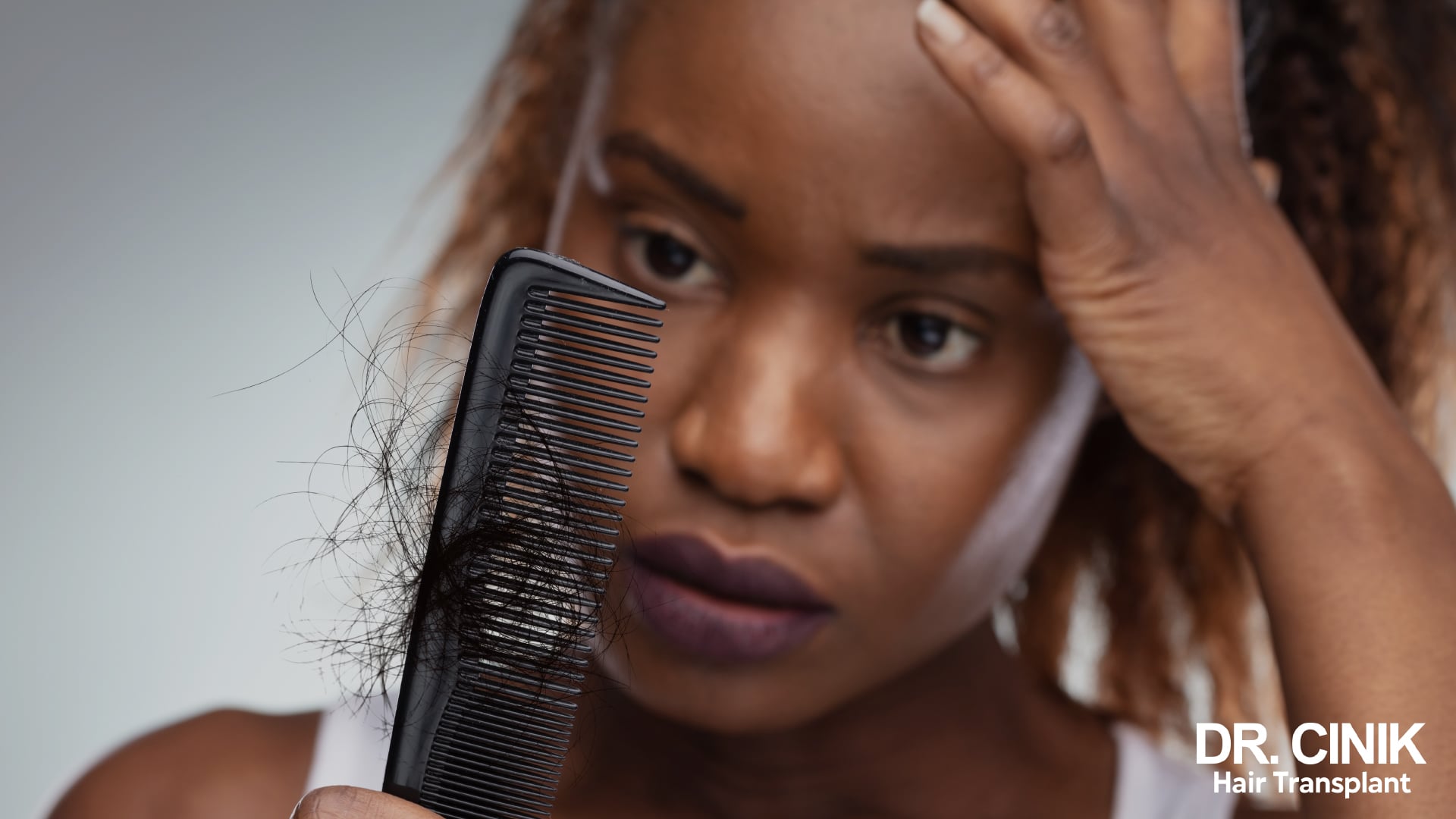 Worried woman holding a black comb full of shed hair, her other hand resting on the top of her head