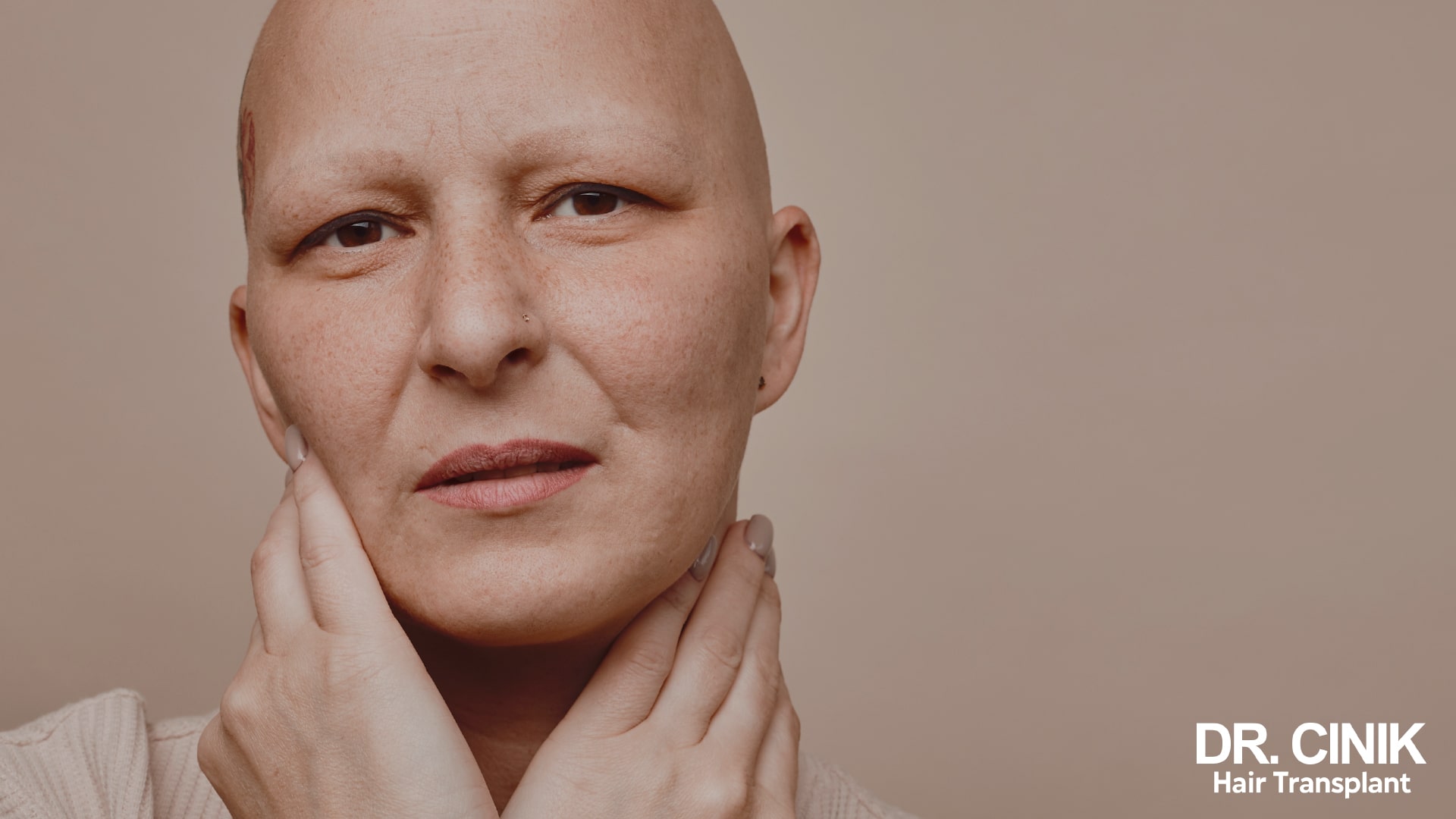 Completely bald woman with no eyebrows or eyelashes, her face resting on her clasped hands