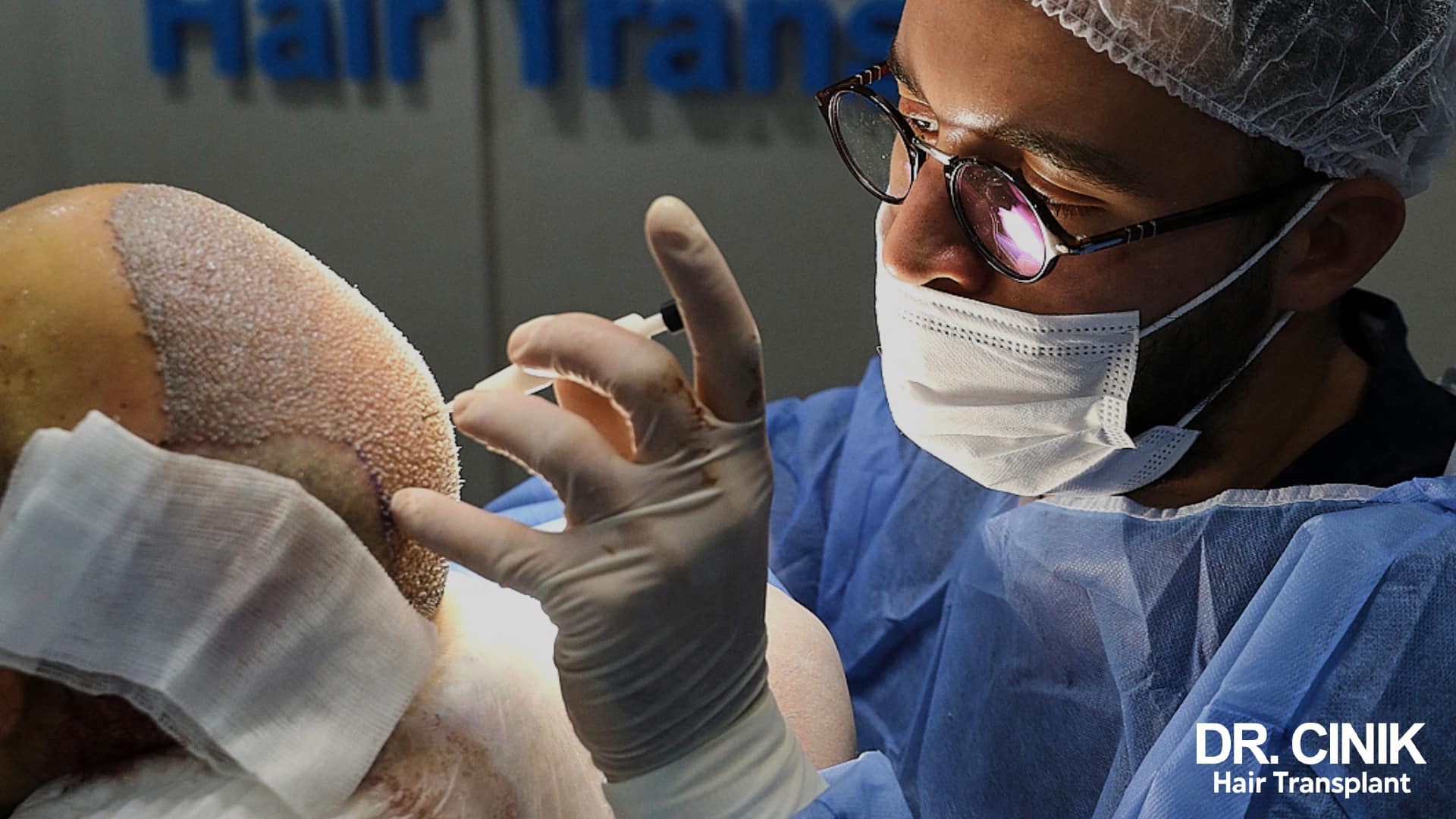 Practitioner in theatre scrubs implanting grafts into the densely prepared frontal area of a patient's scalp