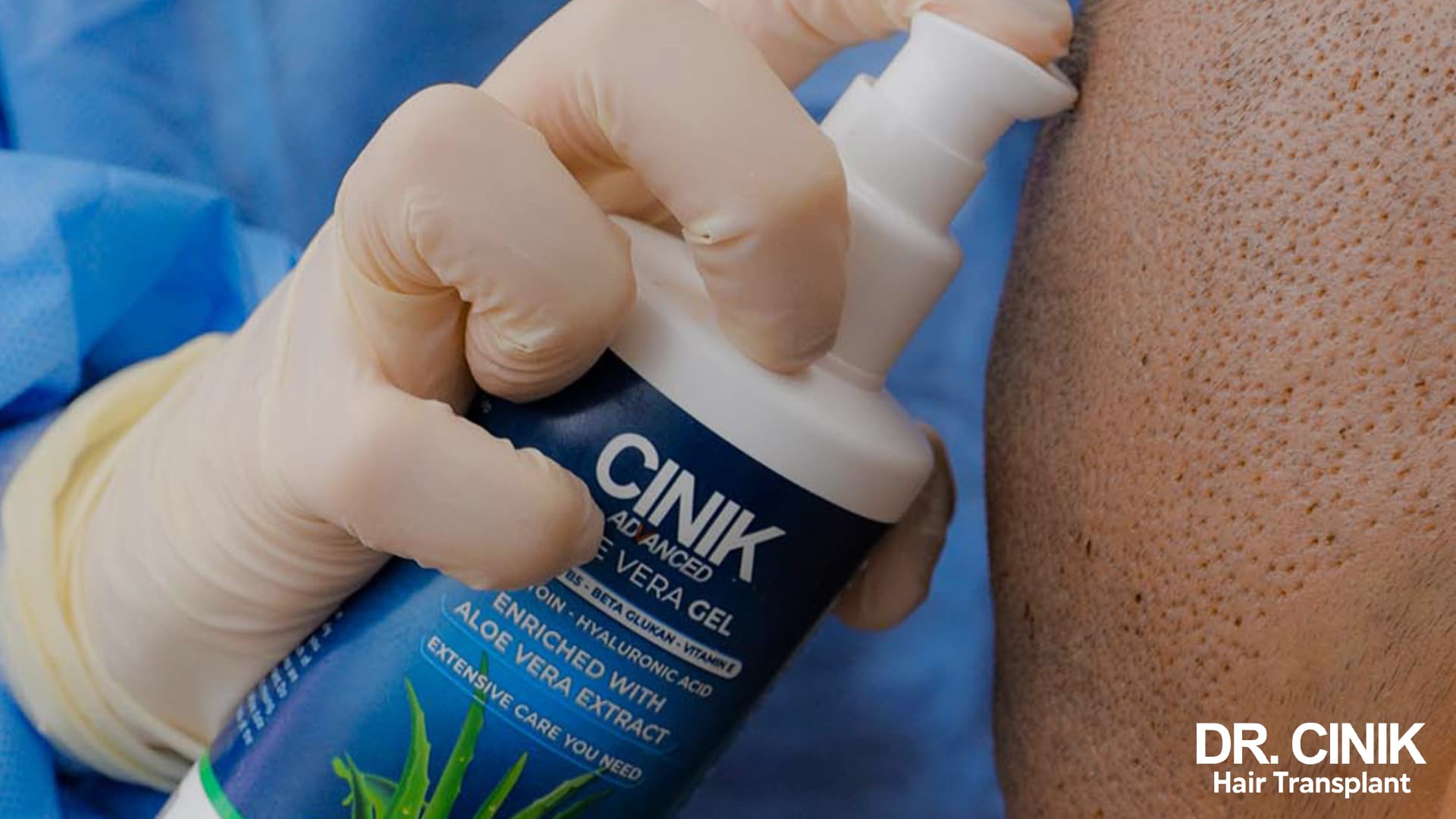 Gloved hand applying a Cinik aloe vera post-operative care spray to a grafted scalp, dotted and reddened