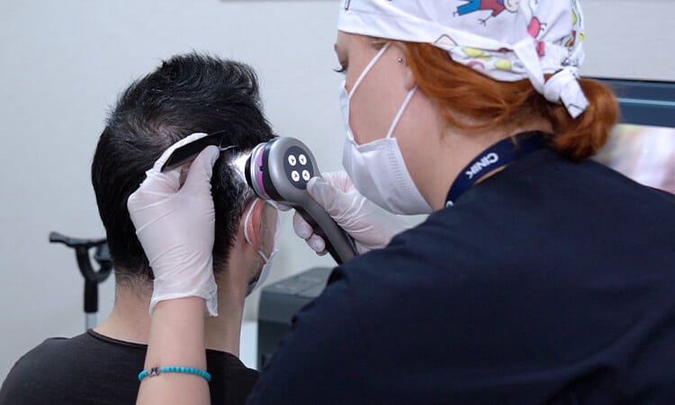 Donor area analysis before a successful hair transplant