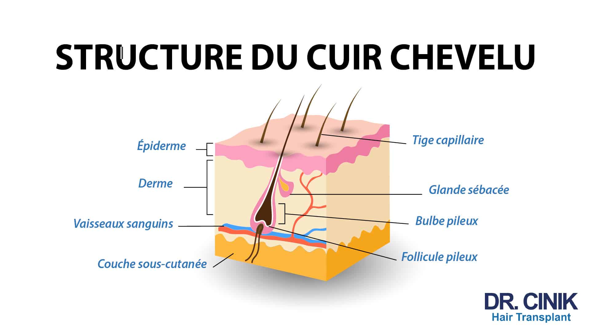 Schéma Dr Cinik de la structure du cuir chevelu légendant l'épiderme, le derme, la couche sous-cutanée, la tige capillaire, la glande sébacée, le bulbe et le follicule pileux ainsi que les vaisseaux sanguins