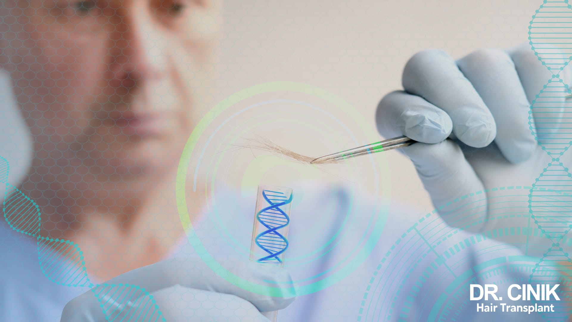 ​​Genes can play a role in alopecia