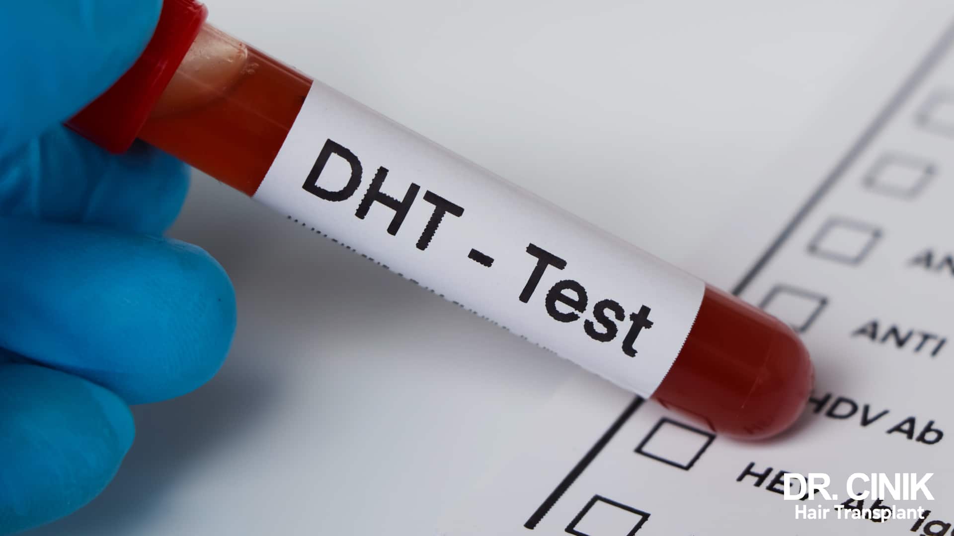 Blood tube labelled DHT-Test held in a gloved hand above a laboratory request form