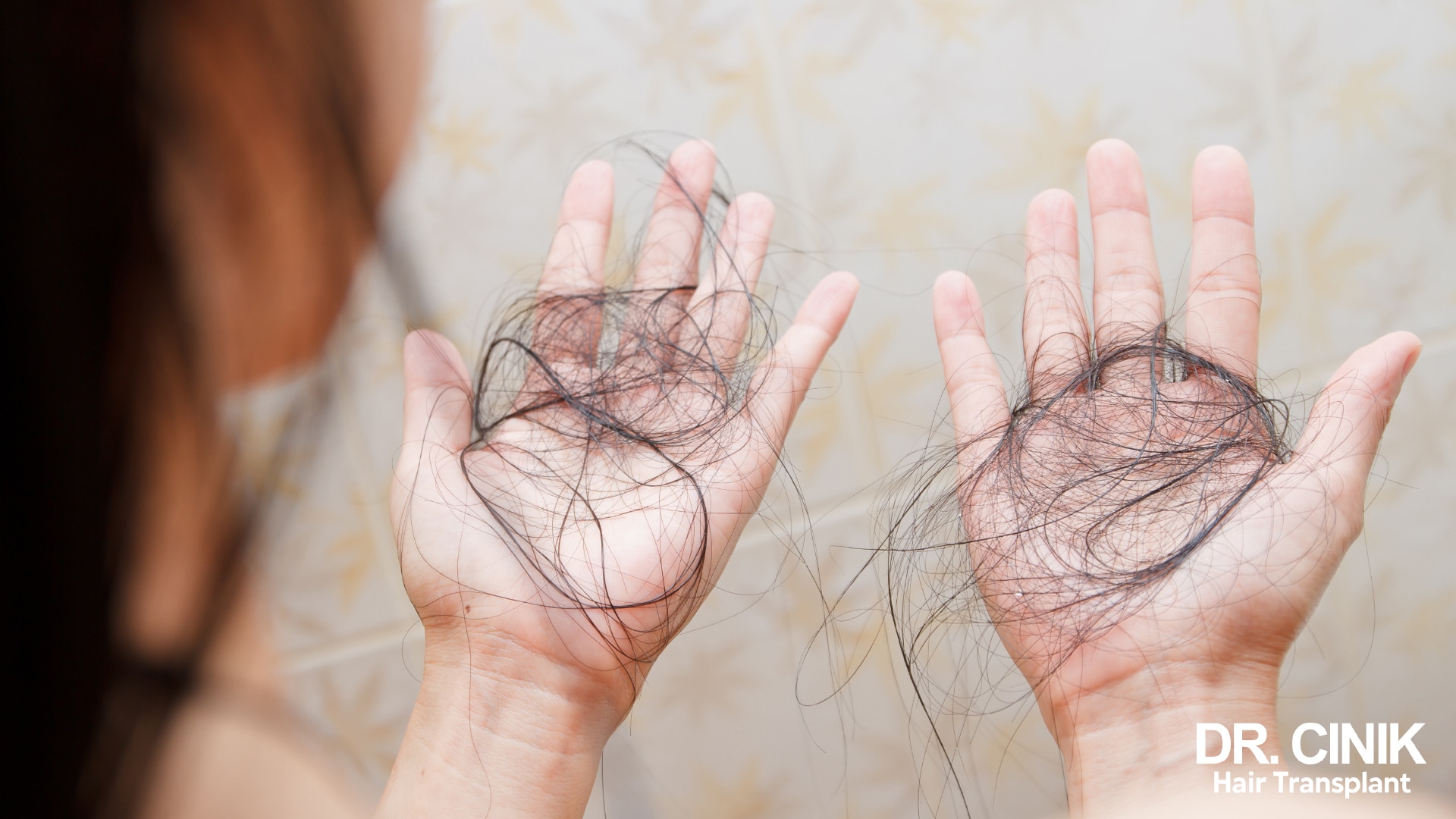 Woman holding out both open palms filled with shed hair