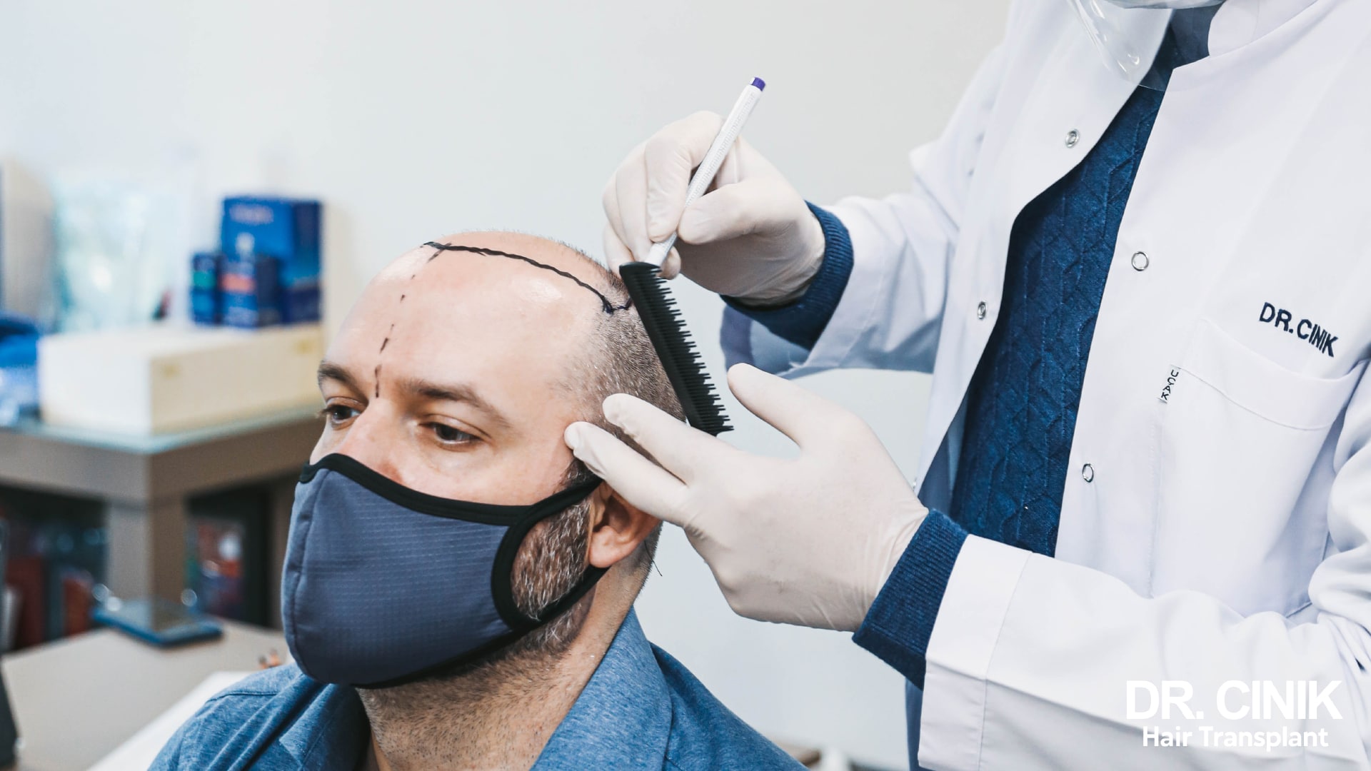 Surgeon drawing the future frontal line with a marker pen on a patient's scalp during consultation