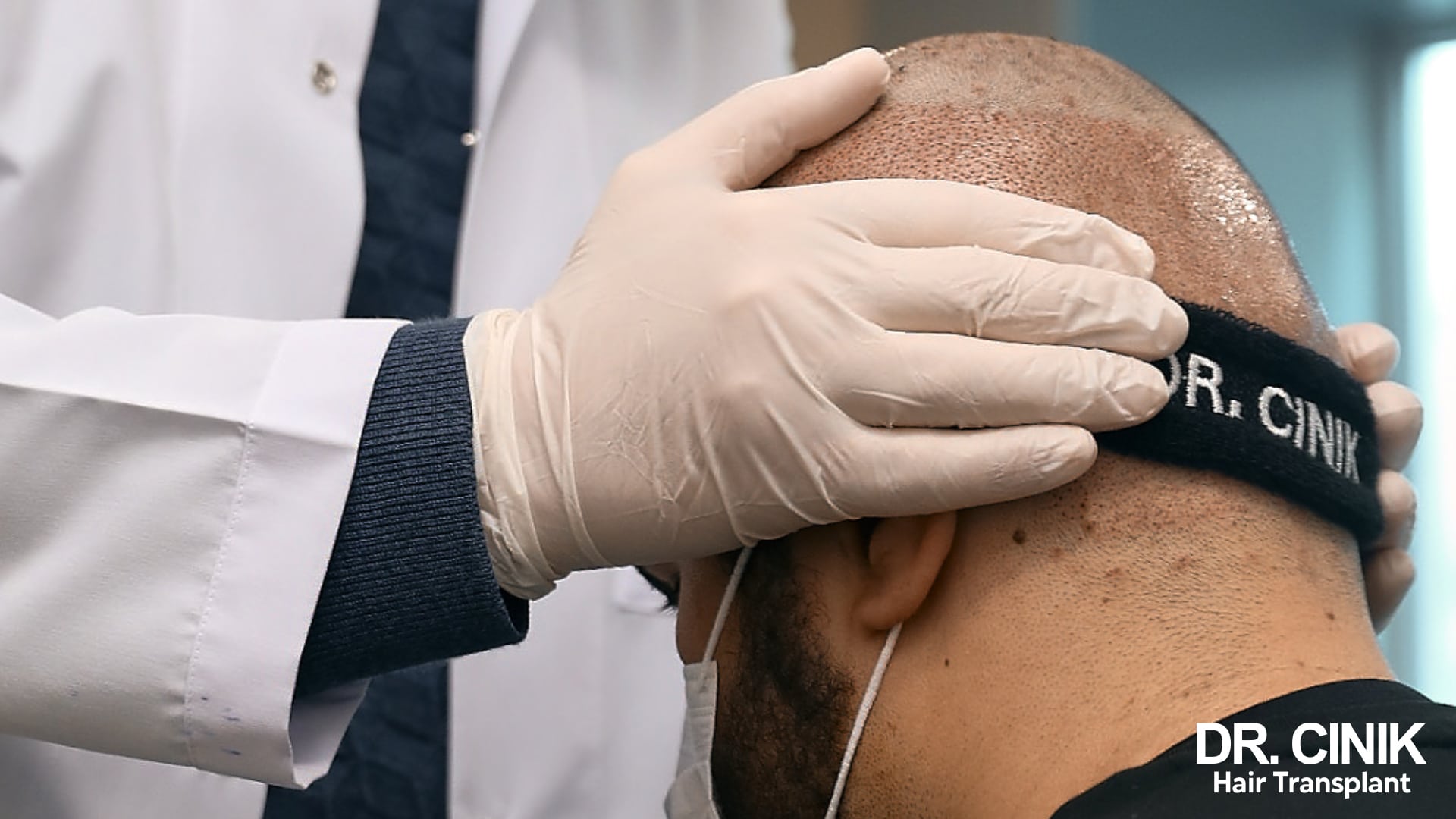 Gloved hand examining the back of a patient's head, where the harvested donor area is visible