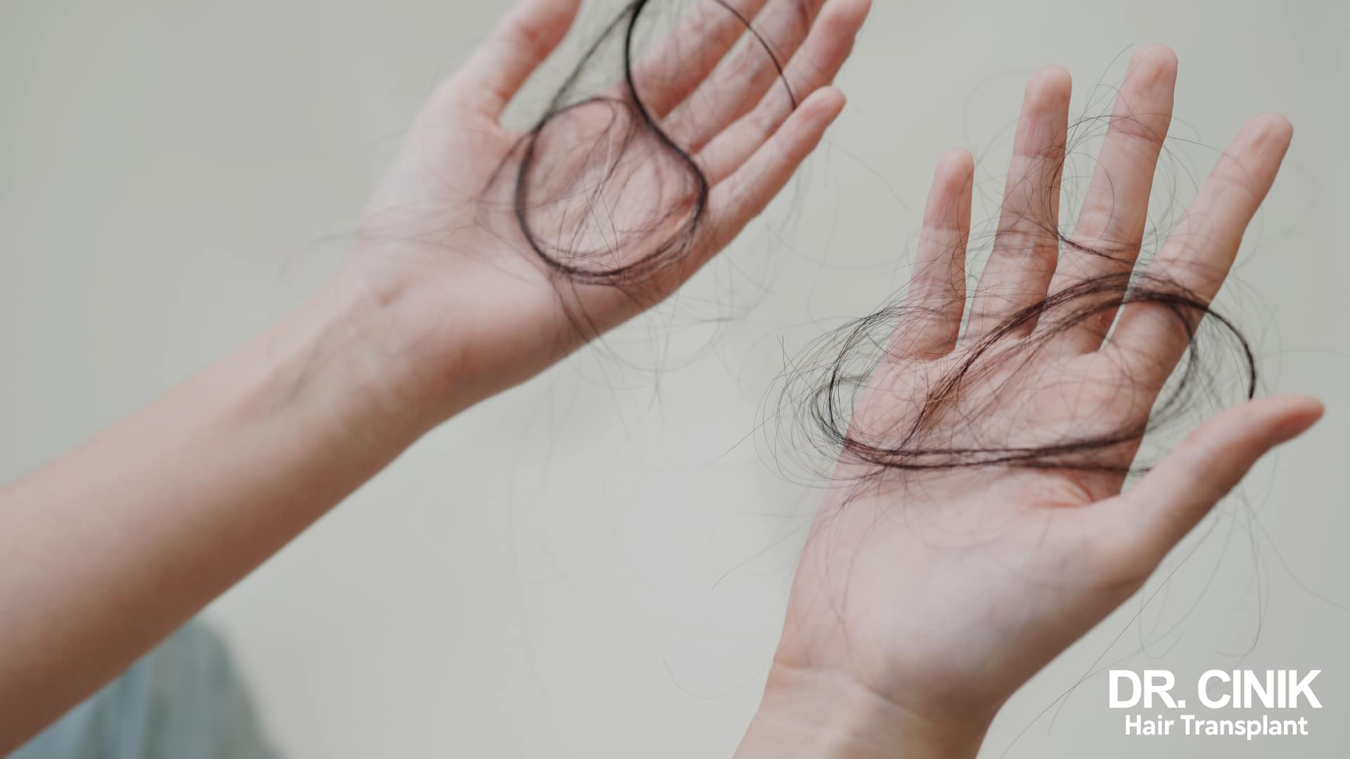 Two open hands covered with long fallen hairs