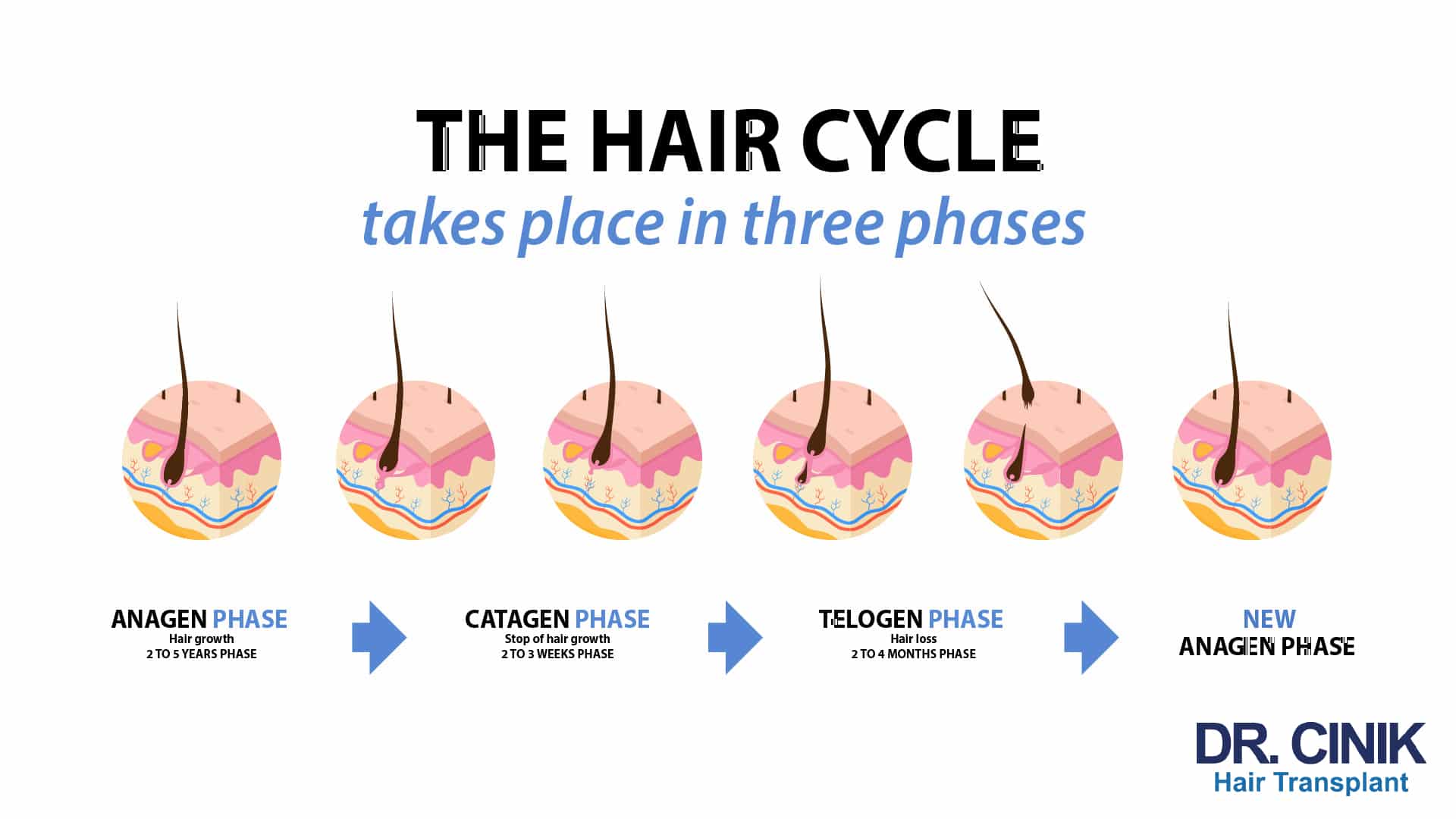 Infographic titled The hair cycle takes place in three phases, showing the anagen phase of hair growth lasting 2 to 5 years, the catagen phase where growth stops lasting 2 to 3 weeks, the telogen phase with hair loss lasting 2 to 4 months, then a new anagen phase