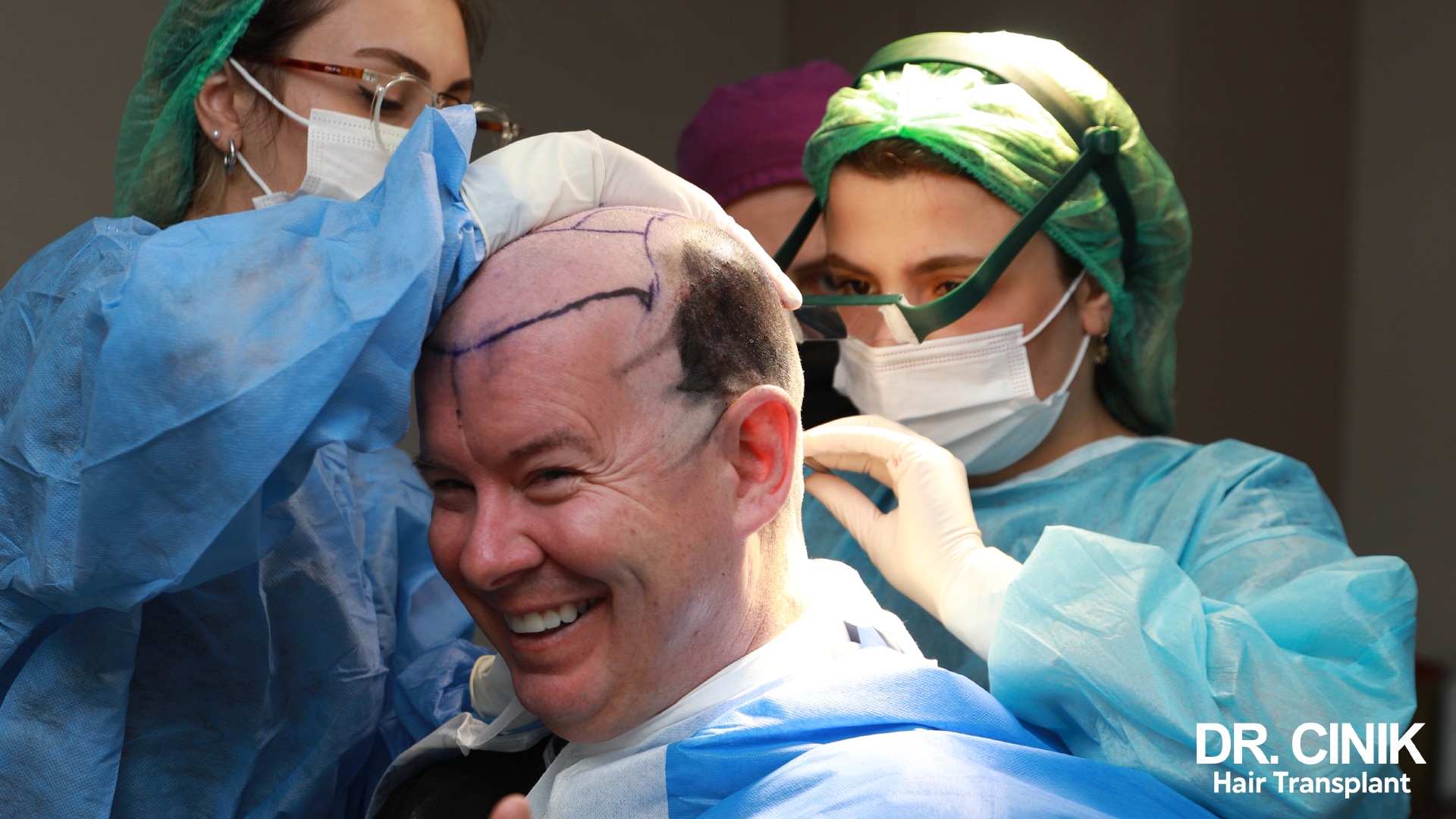 Smiling patient in the operating room, hairline drawn in felt-tip on the scalp, flanked by two assistants