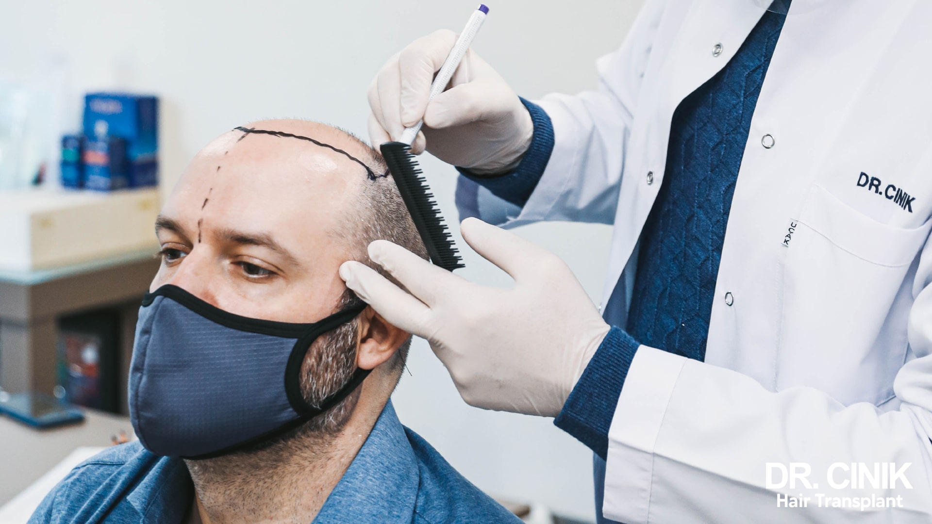 Dr Emrah Cinik marking out the future frontal hairline on a patient's scalp before the procedure