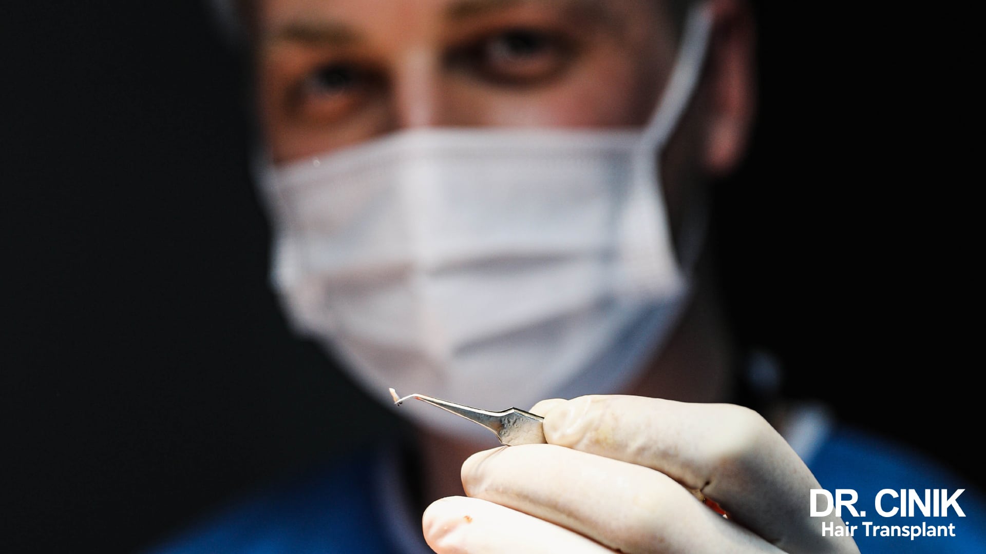 A single graft, its shaft and bulb visible, held at the tip of fine forceps by a masked practitioner