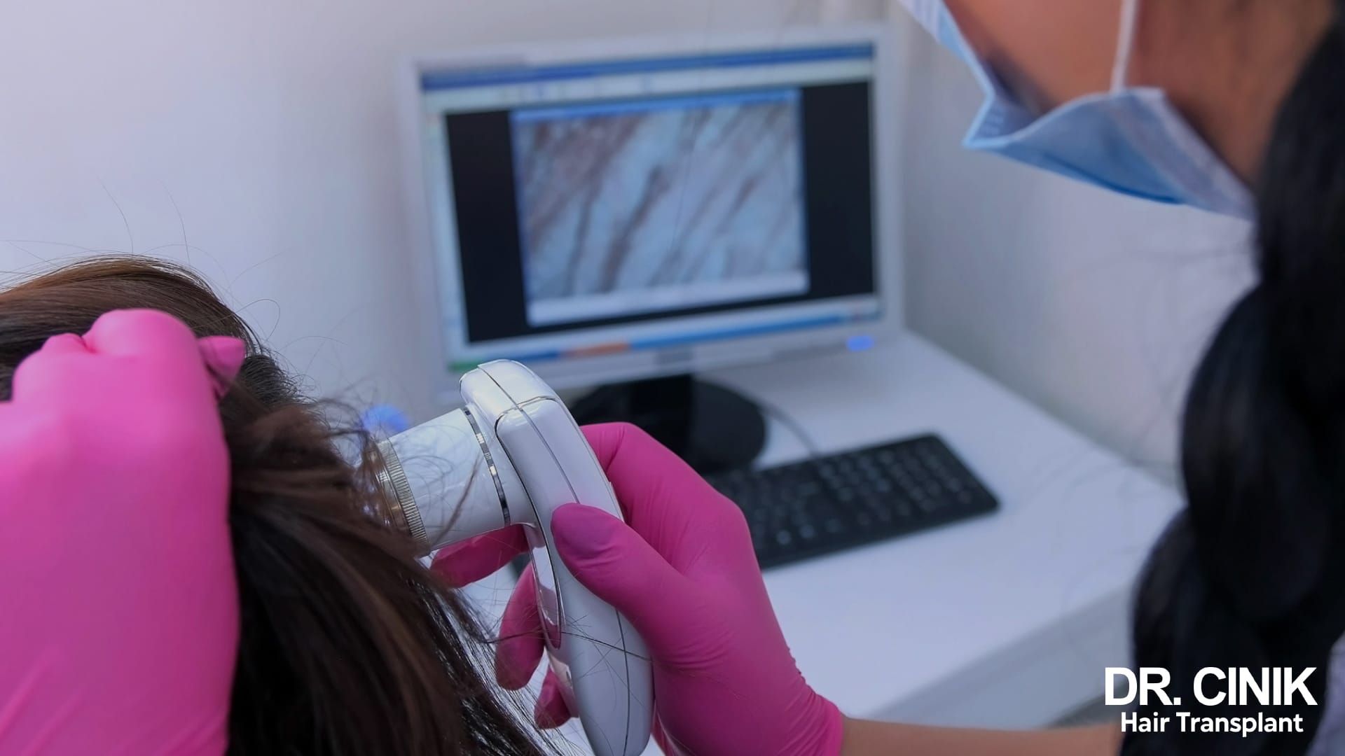 Scalp examination with a magnifying camera, the probe resting on a female patient's hair and the enlarged image of the hairs displayed on the screen beside her