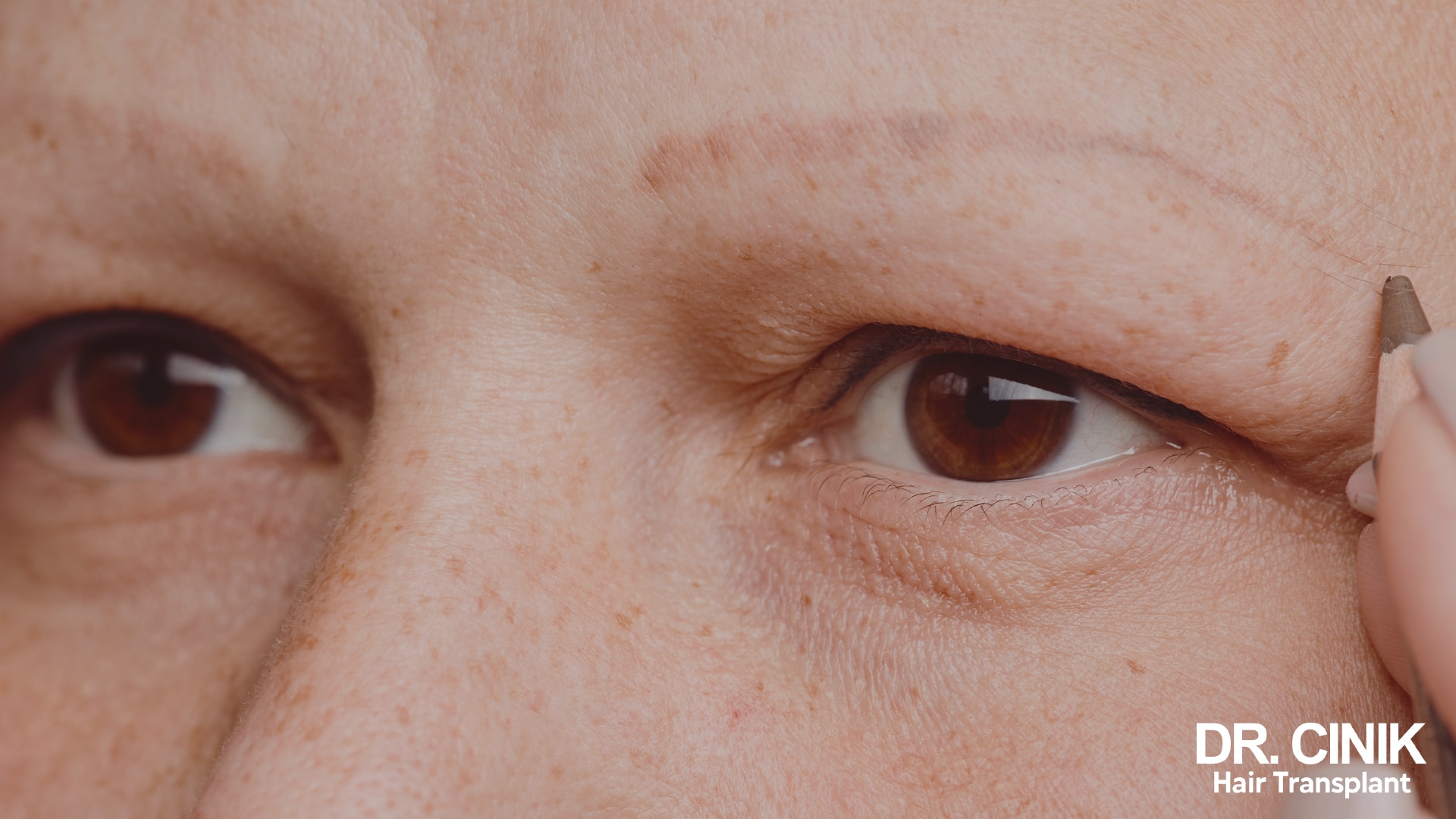 Close view of a woman's eyes, her very sparse eyebrows redrawn with pencil
