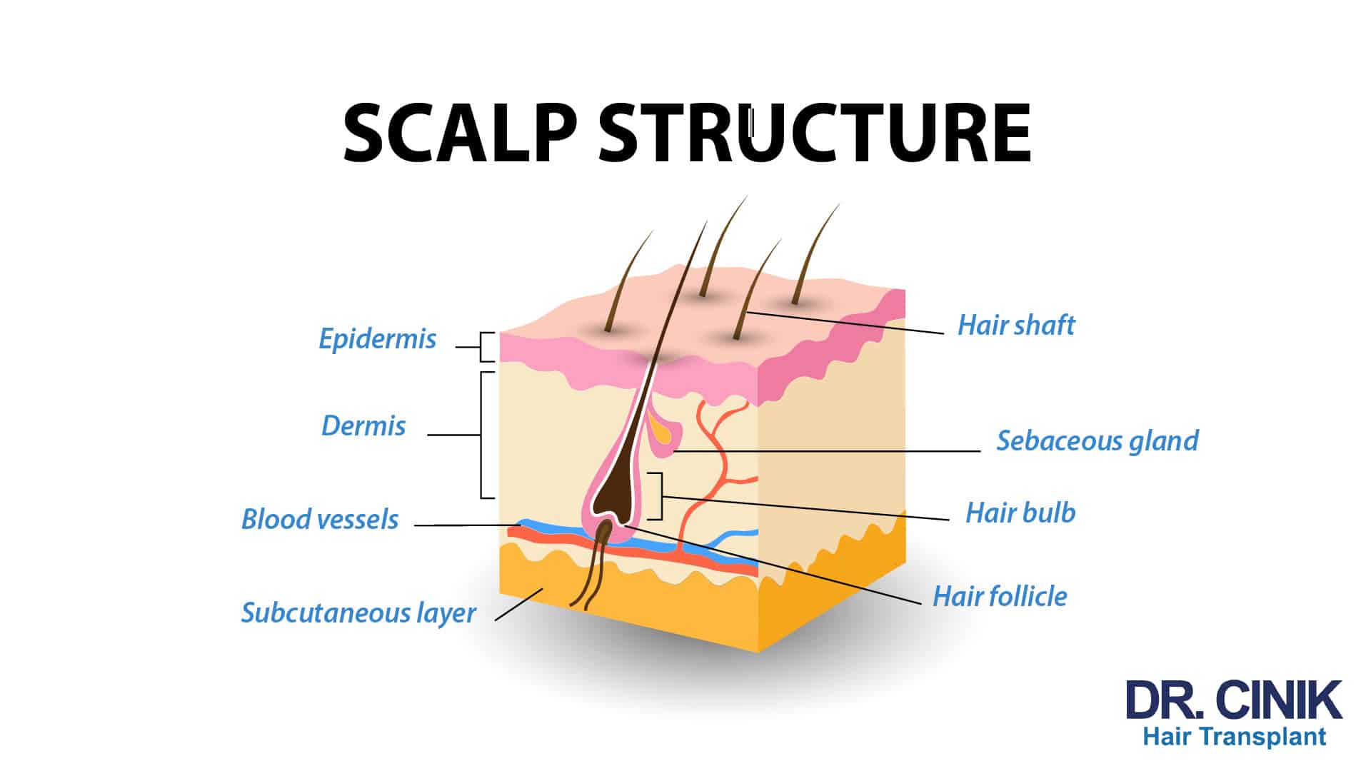 Cross-section diagram of the scalp labelled in English and titled Scalp structure, showing the epidermis, the dermis and the subcutaneous layer, the hair shaft, the sebaceous gland, the hair bulb and the hair follicle, along with the blood vessels feeding it