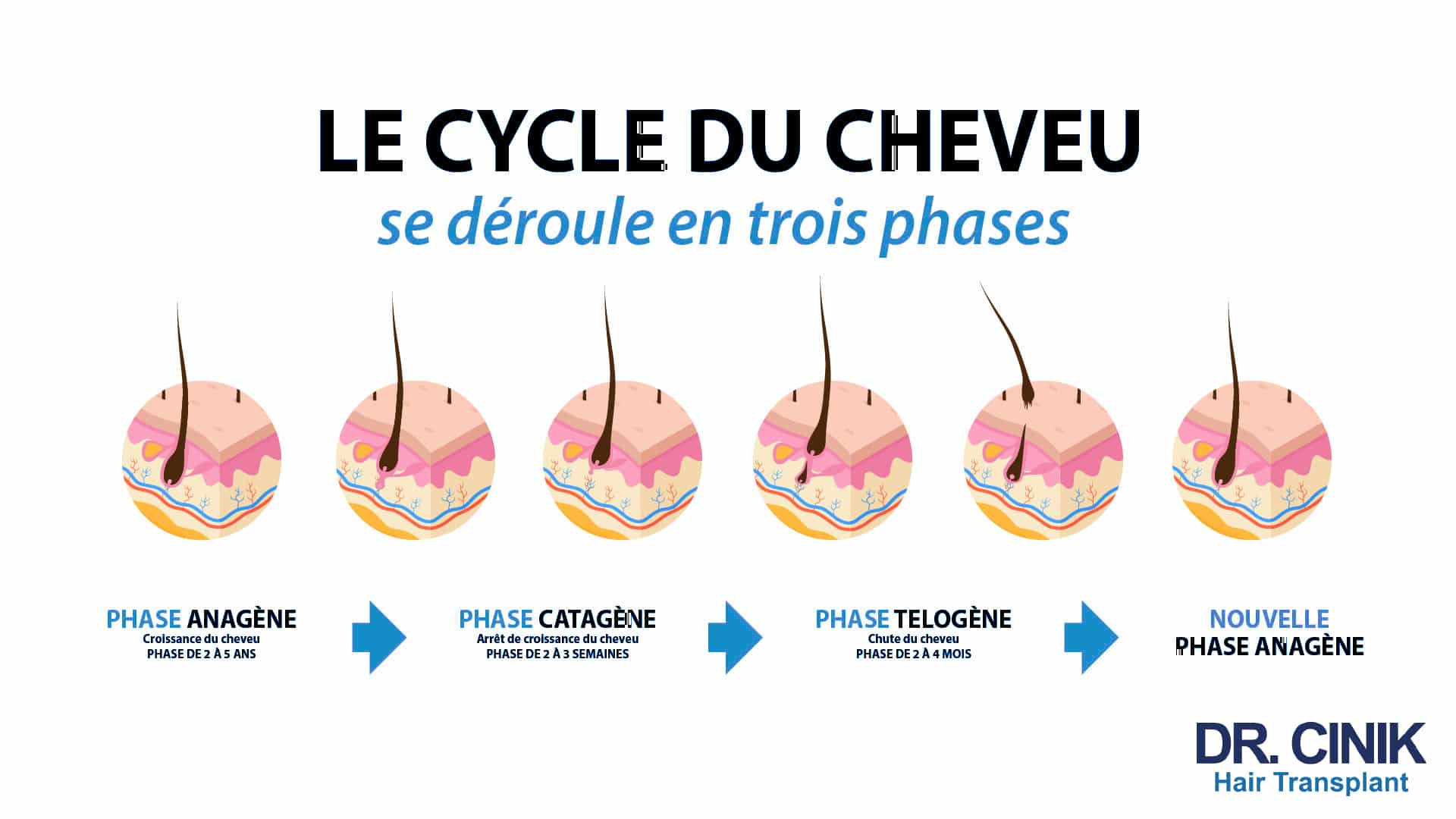 Infographie Dr Cinik intitulée « Le cycle du cheveu se déroule en trois phases », avec six vignettes du follicule et les durées de chaque étape jusqu'au retour à une nouvelle phase anagène