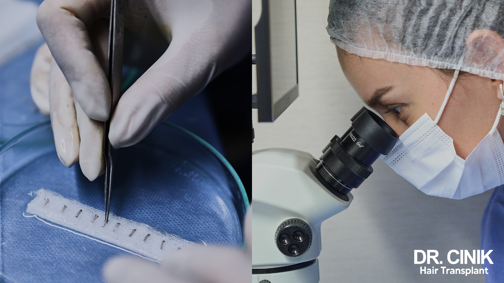 Composite of two shots, on the left grafts lined up with forceps on a compress above a sterile dish, on the right a clinic assistant leaning over a microscope
