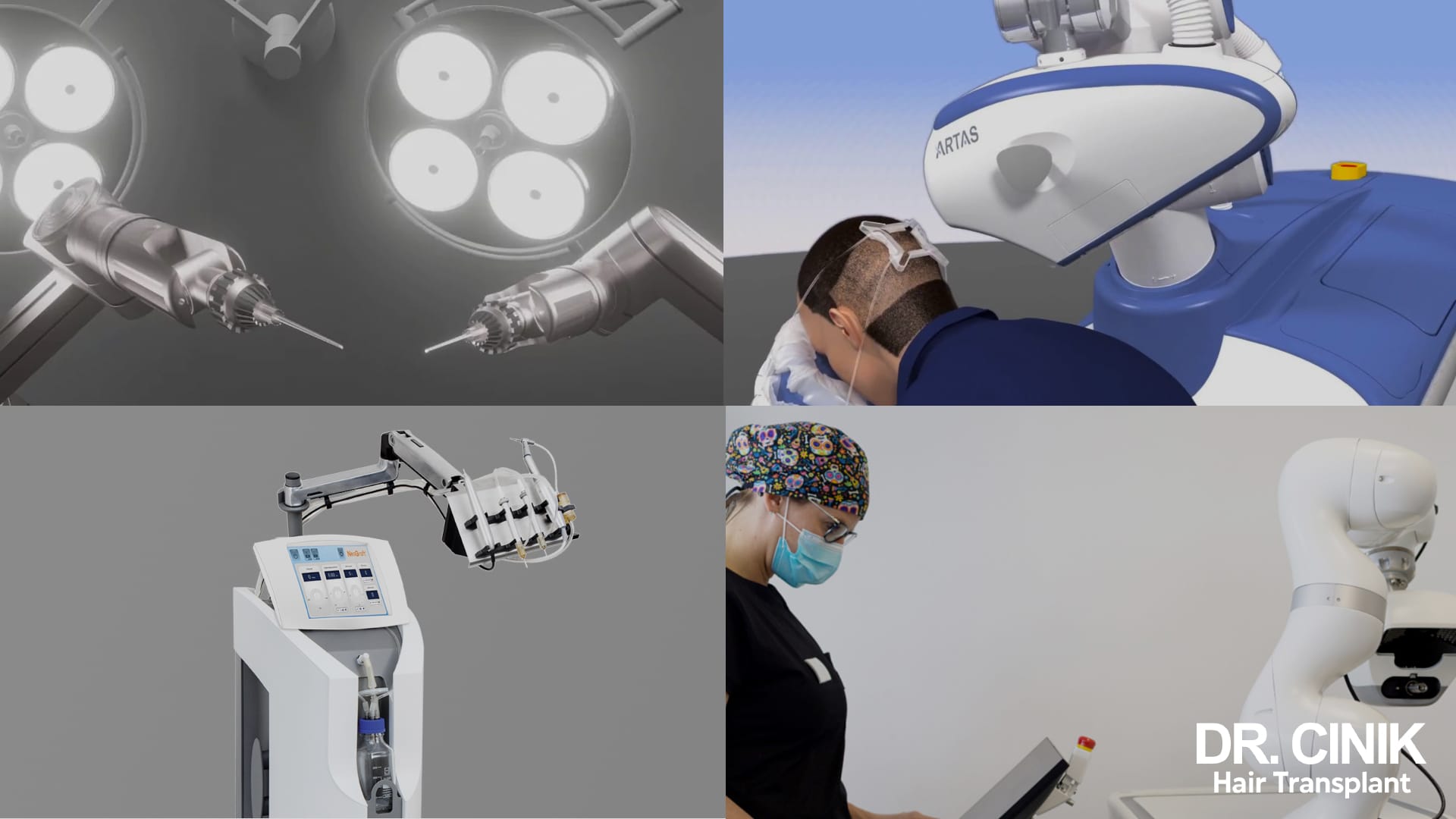 Montage de quatre vignettes présentant des dispositifs de prélèvement automatisés : bras robotisé, robot ARTAS positionné sur le crâne d'un patient, appareil NeoGraft avec écran de contrôle et praticienne travaillant sur un poste relié à un bras robotique