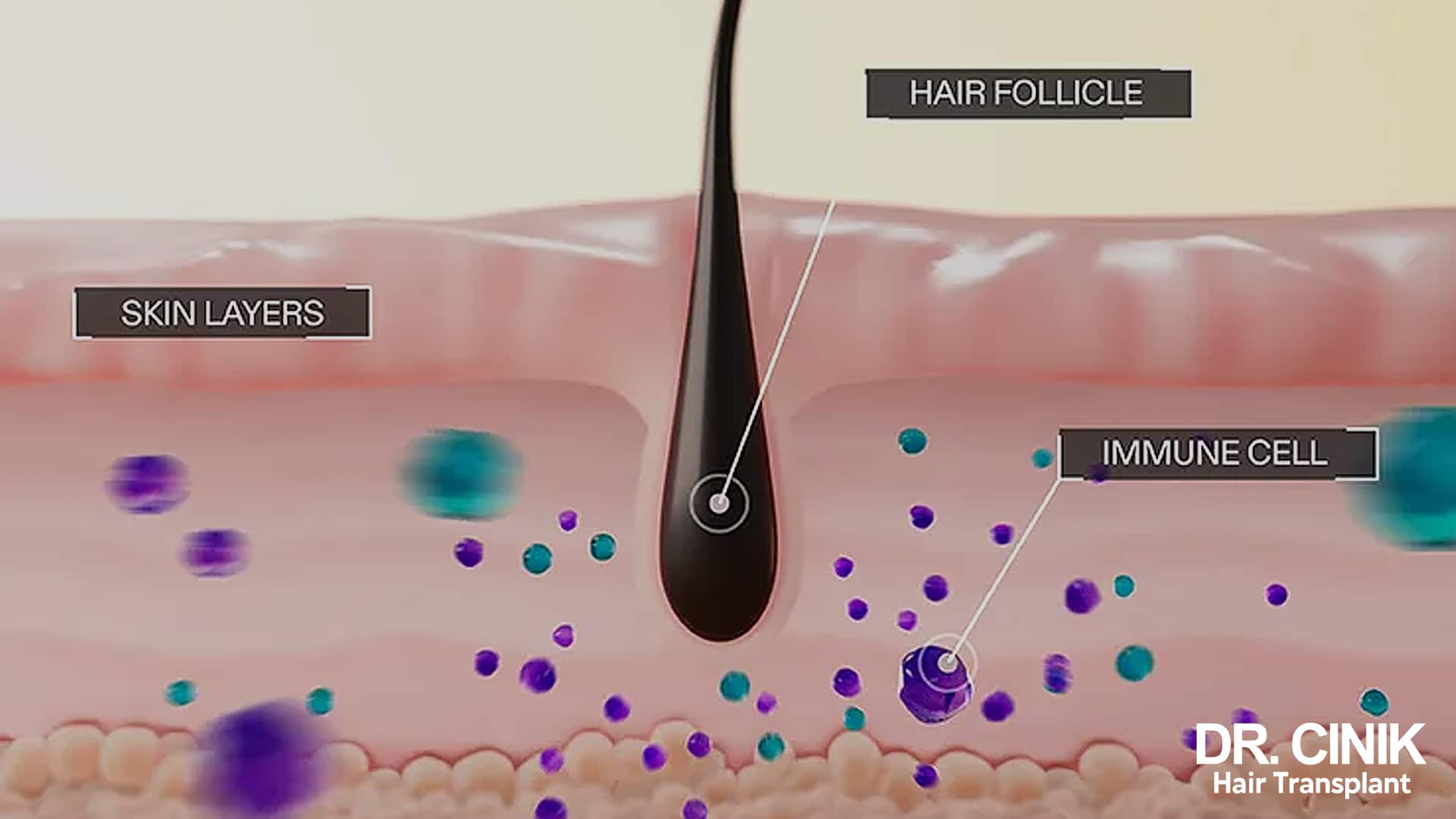 Ritlecitinib: how it works exactly