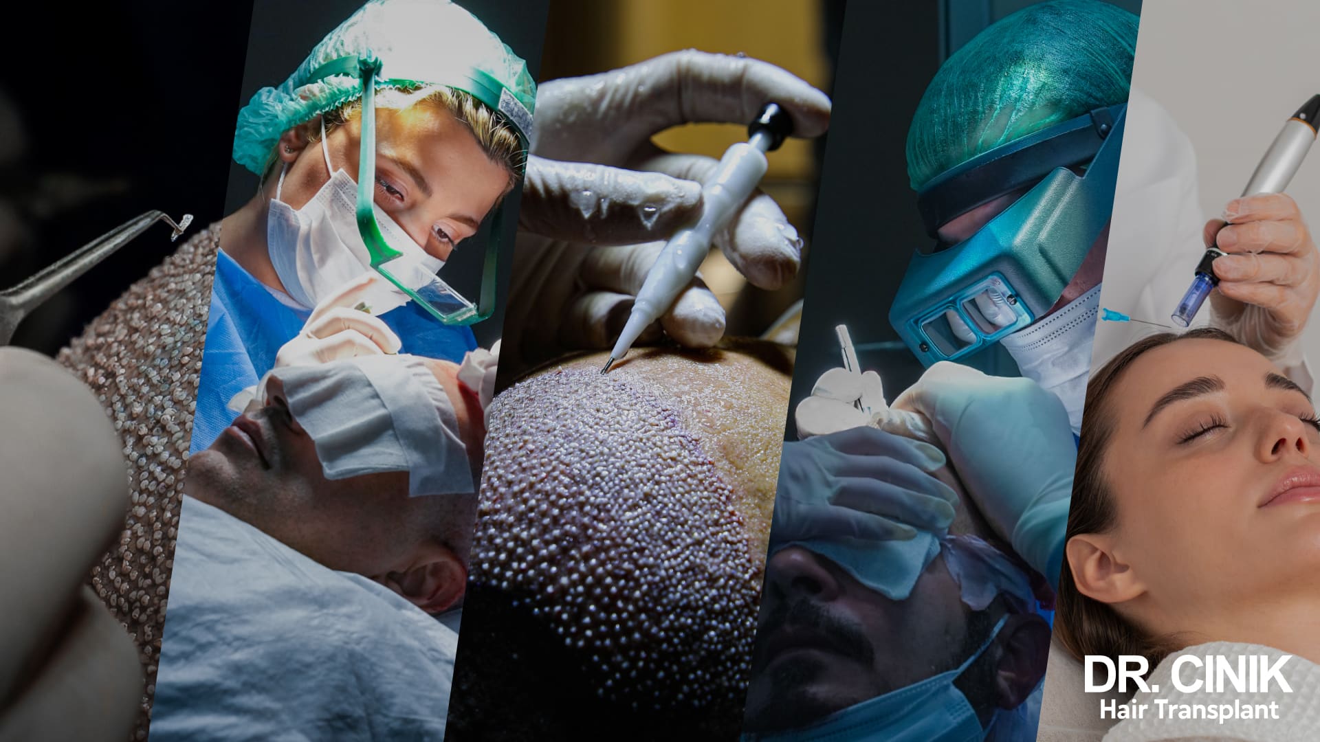 What can be done to repair a failed hair transplant?