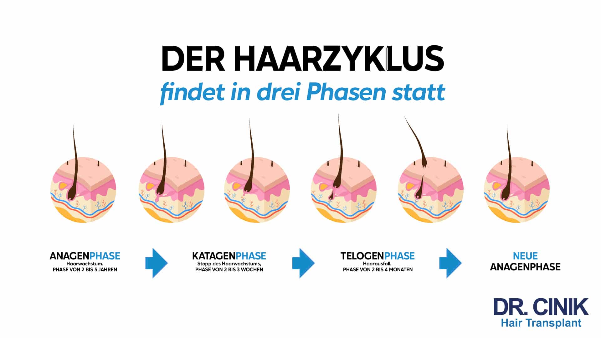 Grafik zum Haarzyklus in drei Phasen: Anagenphase mit Haarwachstum über 2 bis 5 Jahre, Katagenphase mit Wachstumsstopp über 2 bis 3 Wochen, Telogenphase mit Haarausfall über 2 bis 4 Monate, dann eine neue Anagenphase