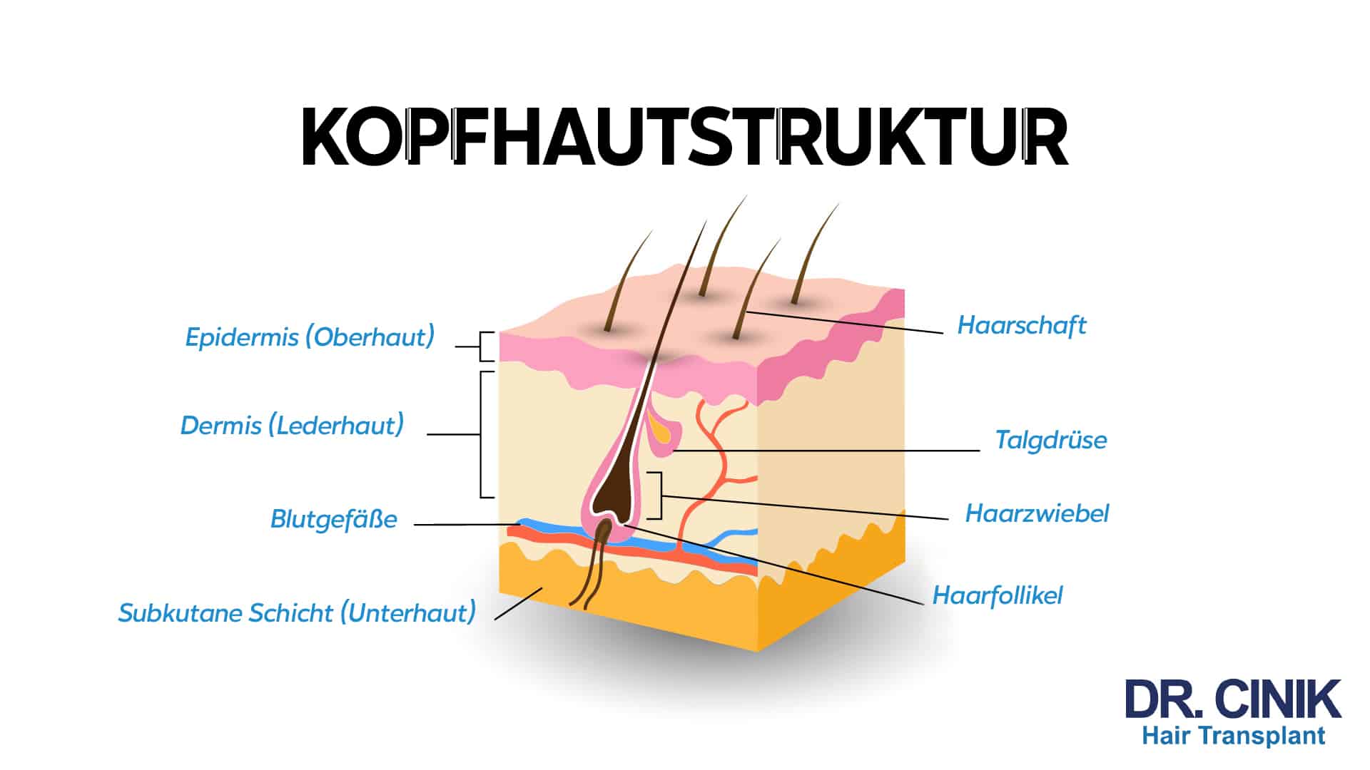 Beschriftete Zeichnung der Kopfhautstruktur mit Epidermis, Dermis, subkutaner Schicht, Blutgefäßen sowie Haarschaft, Talgdrüse, Haarzwiebel und Haarfollikel