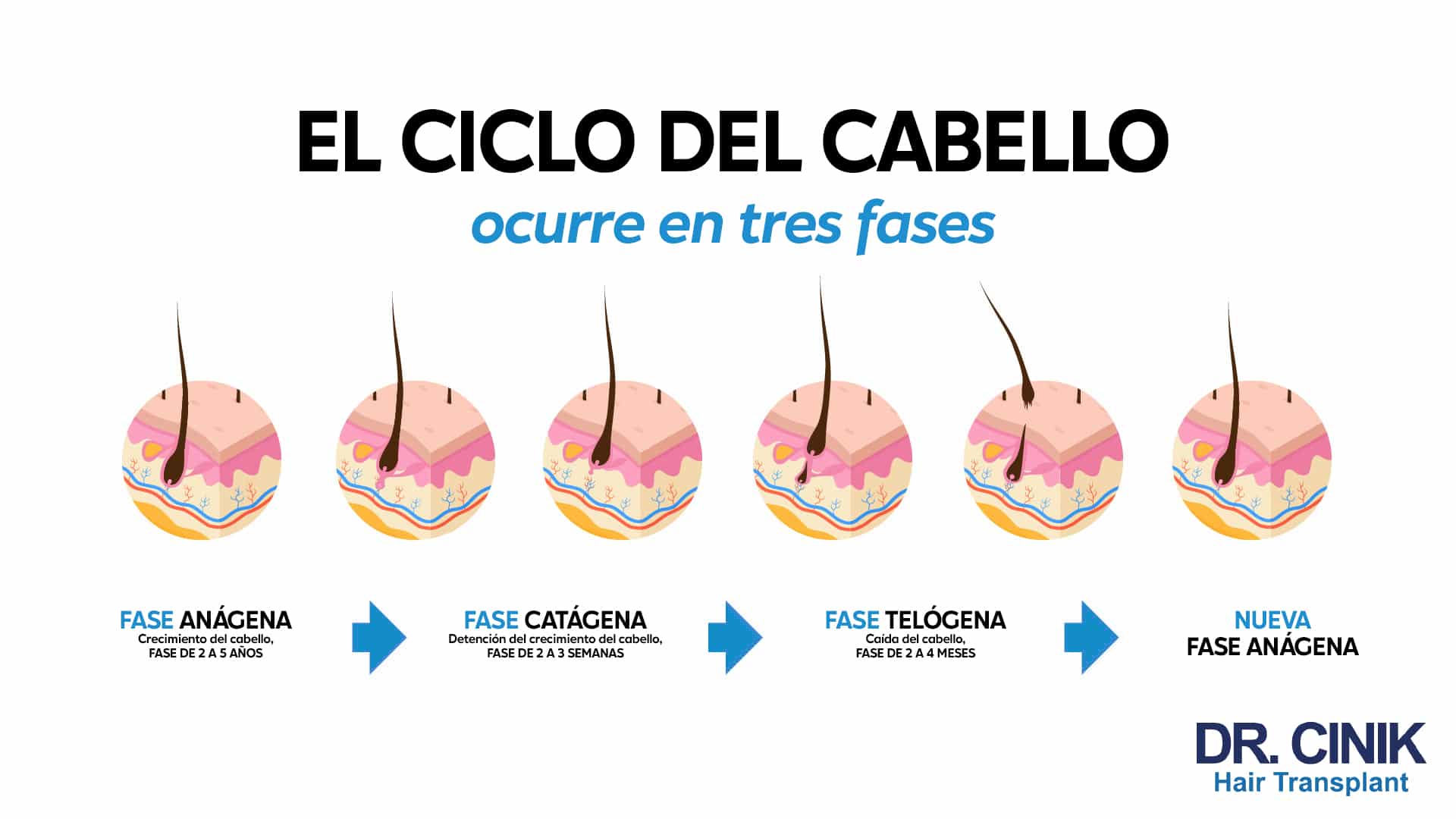 Infografía titulada estructura del ciclo del cabello en español: el ciclo del cabello ocurre en tres fases, con seis folículos ilustrados en corte y las etiquetas fase anágena de crecimiento de 2 a 5 años, fase catágena de detención de 2 a 3 semanas, fase telógena de caída de 2 a 4 meses, y nueva fase anágena