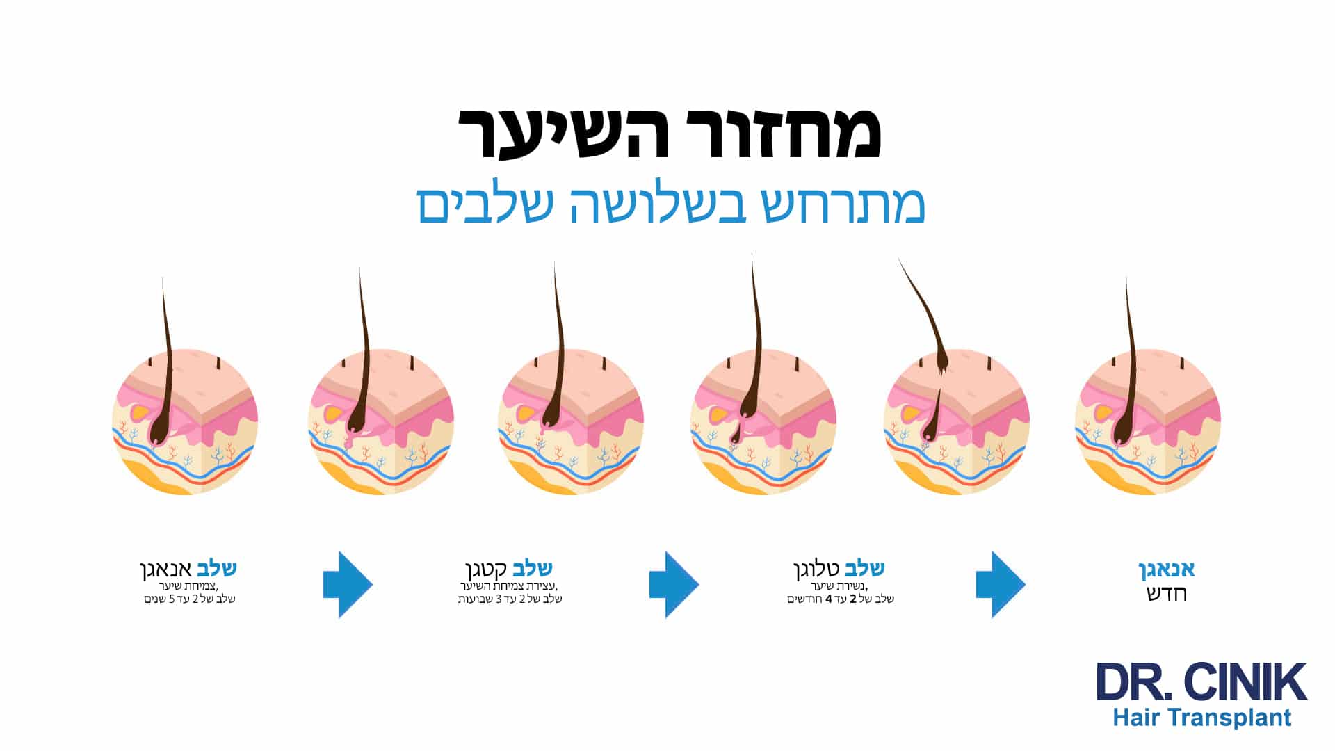 אינפוגרפיקה של ד