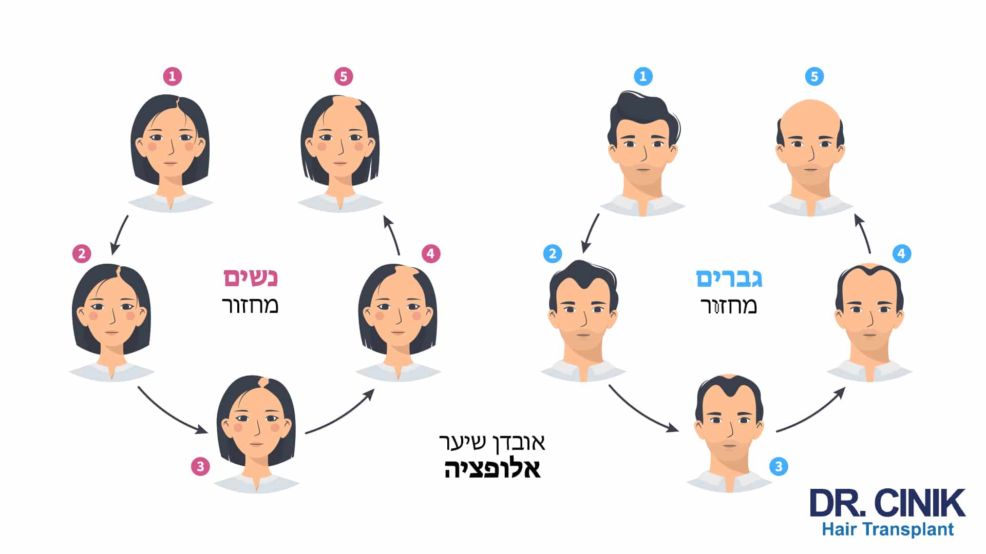 אינפוגרפיה בעברית המשווה בחמישה שלבים ממוספרים את מחזור אובדן השיער אצל נשים ואצל גברים