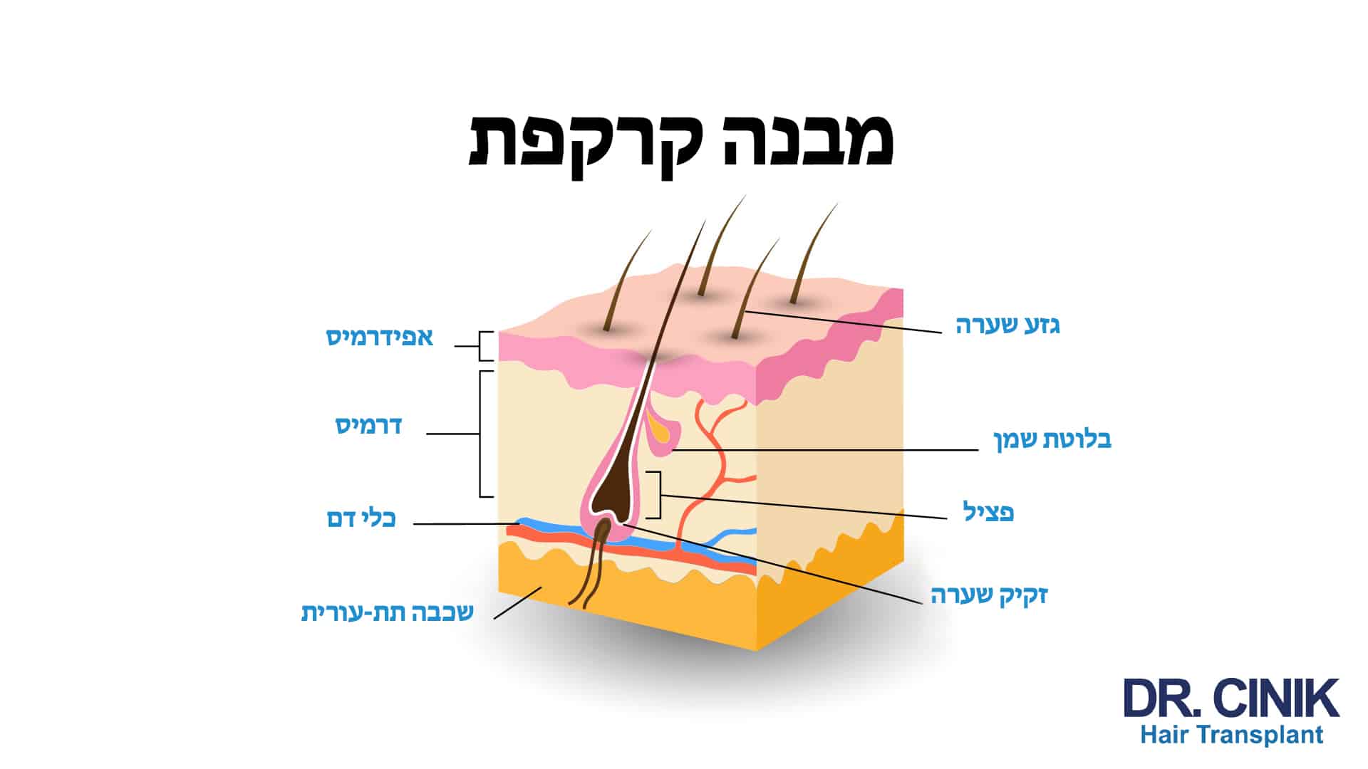 תרשים של ד