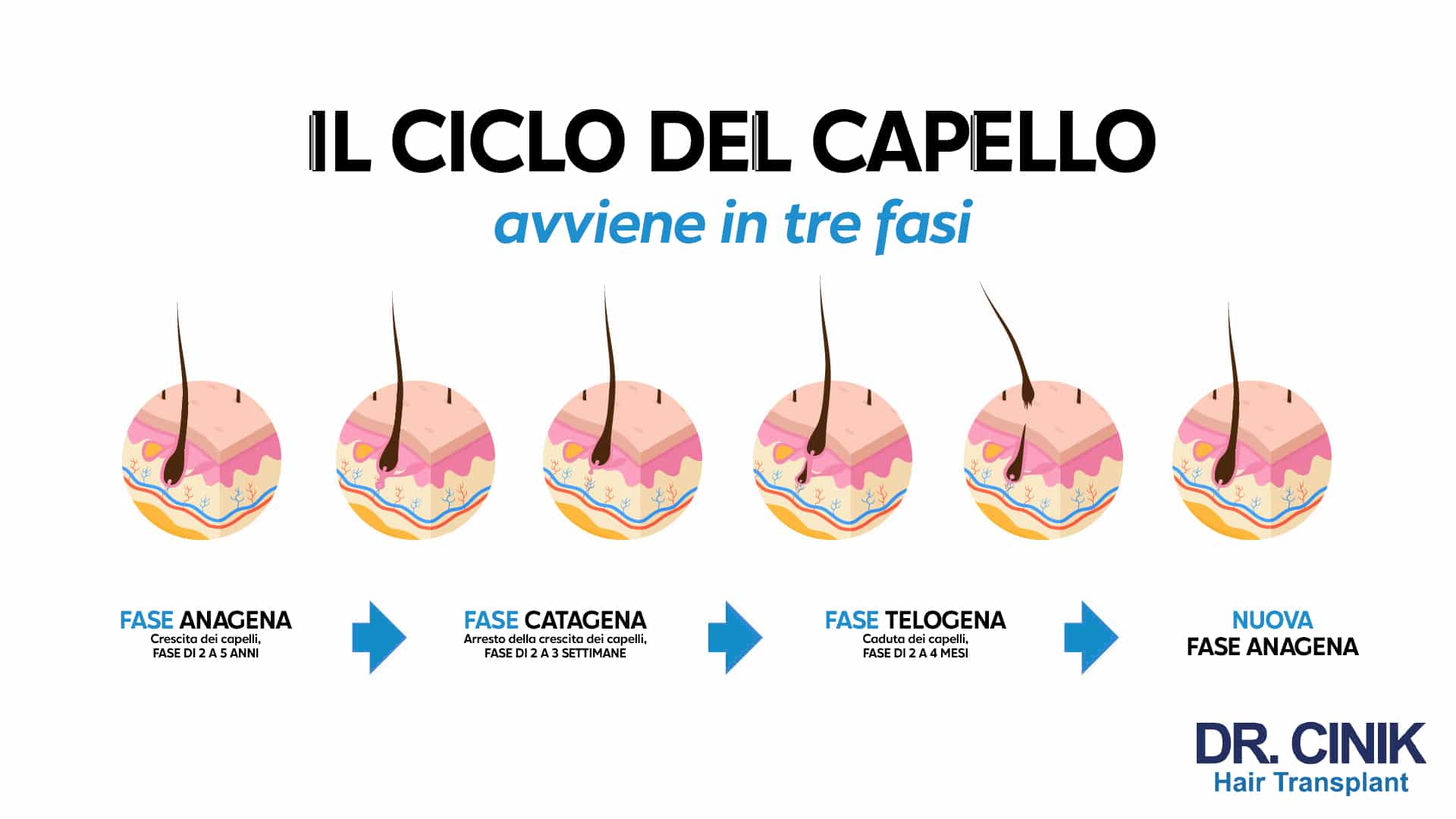 Infografica del Dr. Cinik intitolata Il ciclo del capello avviene in tre fasi, con sei vignette del follicolo e le durate indicate: fase anagena di crescita da 2 a 5 anni, fase catagena di arresto della crescita da 2 a 3 settimane, fase telogena di caduta da 2 a 4 mesi, poi una nuova fase anagena