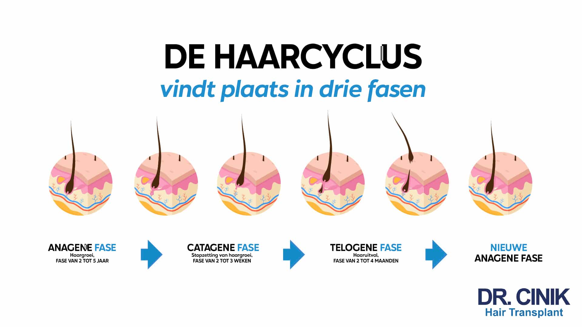 Infographic van Dr. Cinik met de titel De haarcyclus vindt plaats in drie fasen, met zes weergaven van het haarzakje en de duur van elke etappe tot aan een nieuwe anagene fase