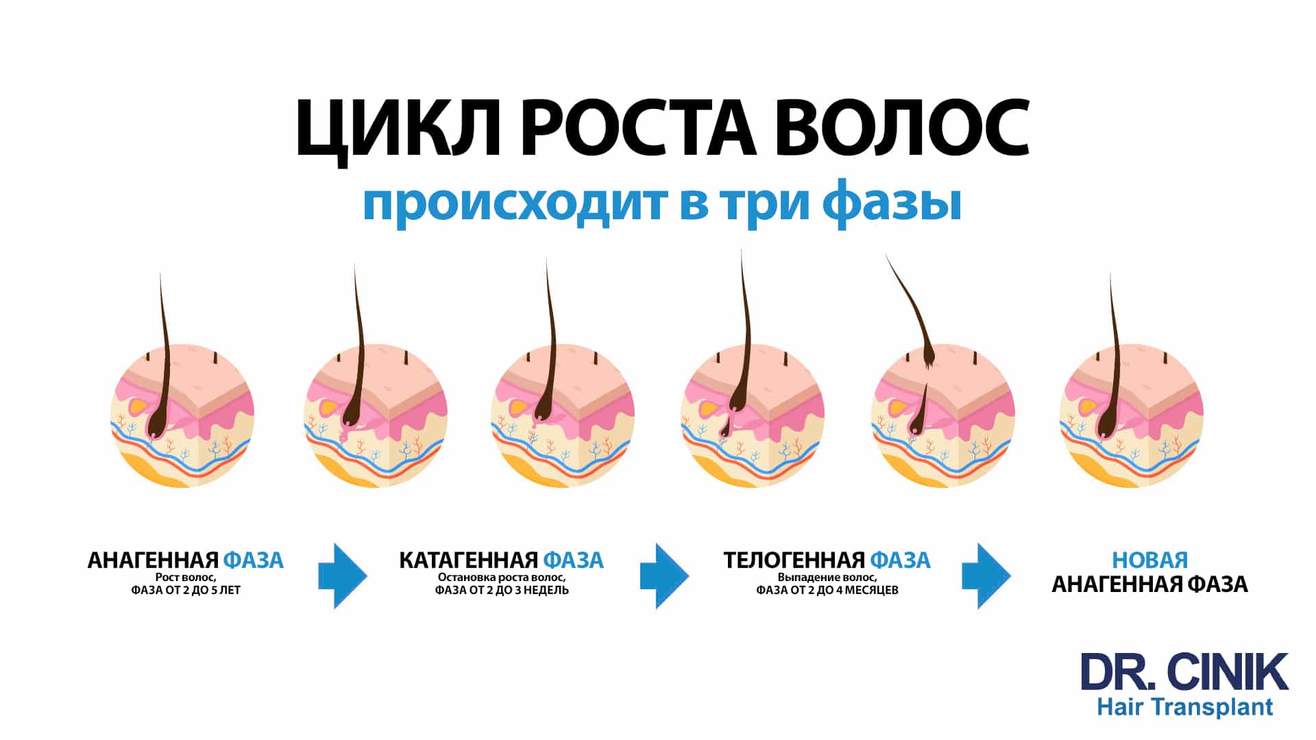 Инфографика с заголовком цикл роста волос происходит в три фазы: анагенная фаза, рост волос, от 2 до 5 лет; катагенная фаза, остановка роста волос, от 2 до 3 недель; телогенная фаза, выпадение волос, от 2 до 4 месяцев; затем новая анагенная фаза